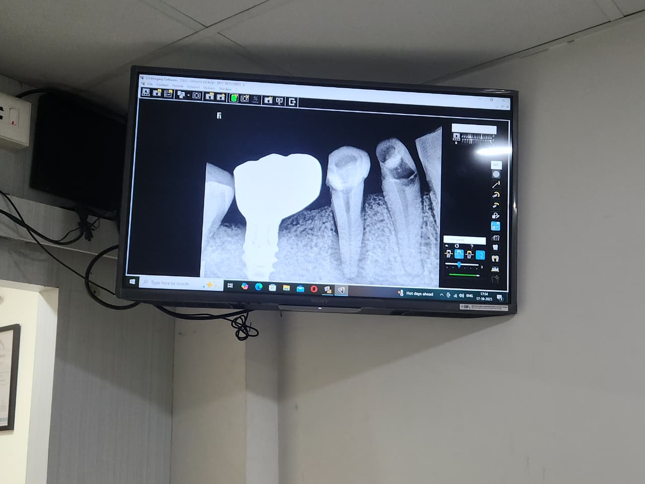 dental implants clinic near by 2026