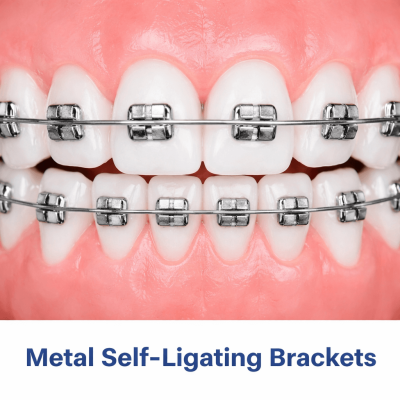 teeth braces price near me 2026